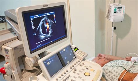 ecocardiograma preço-4